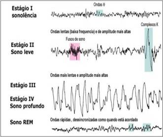 figura_5_-_estagios_sono